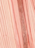Shortleaf Pine — This image shows the Shortleaf Pine tree, specifically its species name, Pinus echinata. | https://www.wood-database.com/wp-content/uploads/shortleaf-pine-146x200.jpg